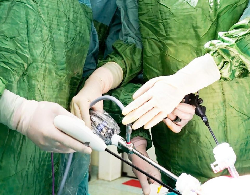 Laparoskopska operacija